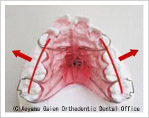 歯列弓の拡大写真